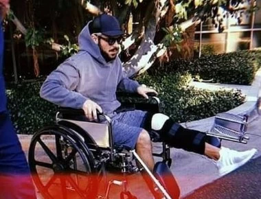 Σταρ του Hollywood υποβλήθηκε σε χειρουργική επέμβαση (φωτο)